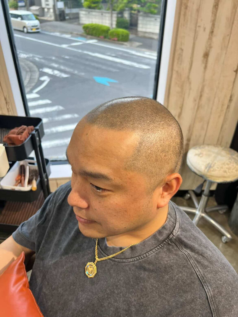 スカルプインク施術後の男性